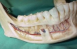 Zahnarzt München: Risiken und Gefahren bei Zahn und Kiefer Operationen 